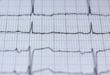 apex growth pulse device